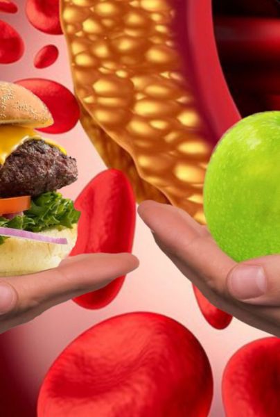 Colesterol: qué alimentos consumir y cuáles limitar para una vida saludable.